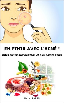 Couverture de En finir avec l'acné ! Dites adieu aux boutons