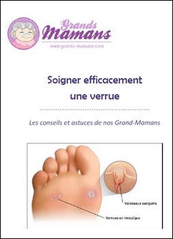 Couverture de Verrues : comment les soigner ?